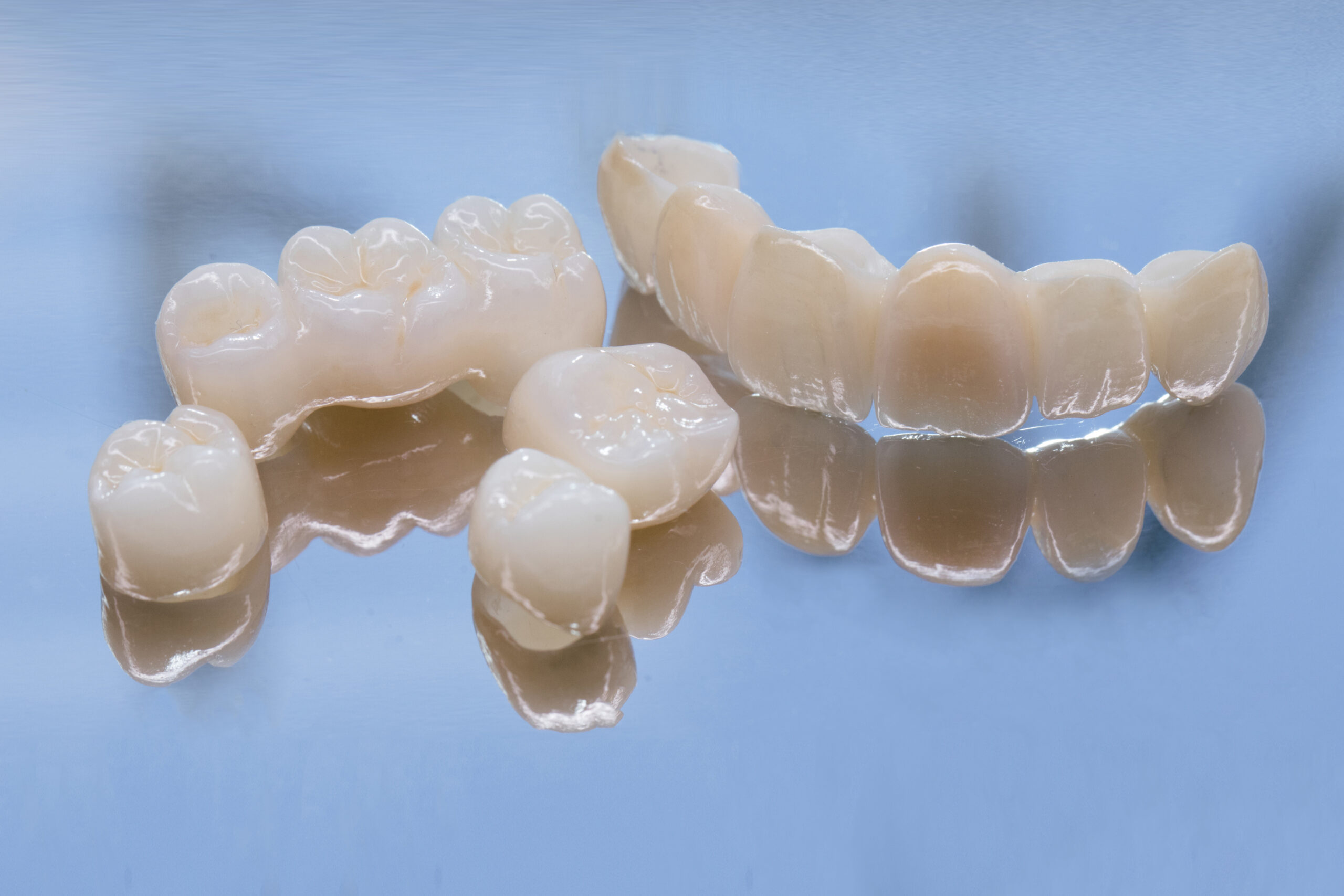 Metal Free Ceramic Dental Crowns. Ceramic zirconium in final version. Staining and glazing. Precision design and high quality materials