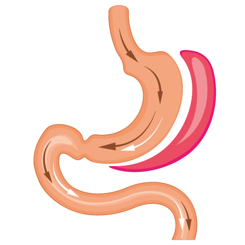 gastric sleeve operation tukey